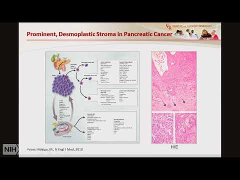 TRACO 2017: Pancreatic cancer and Nanotechnology
