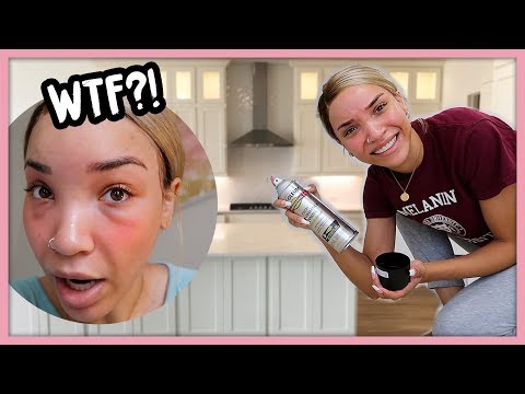 Am I ALLERGIC to my NEW HOUSE?!