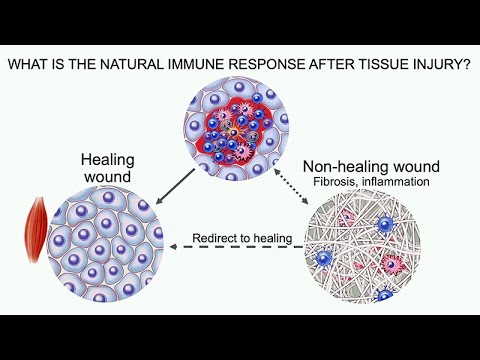 The Immune System in Regenerative Medicine